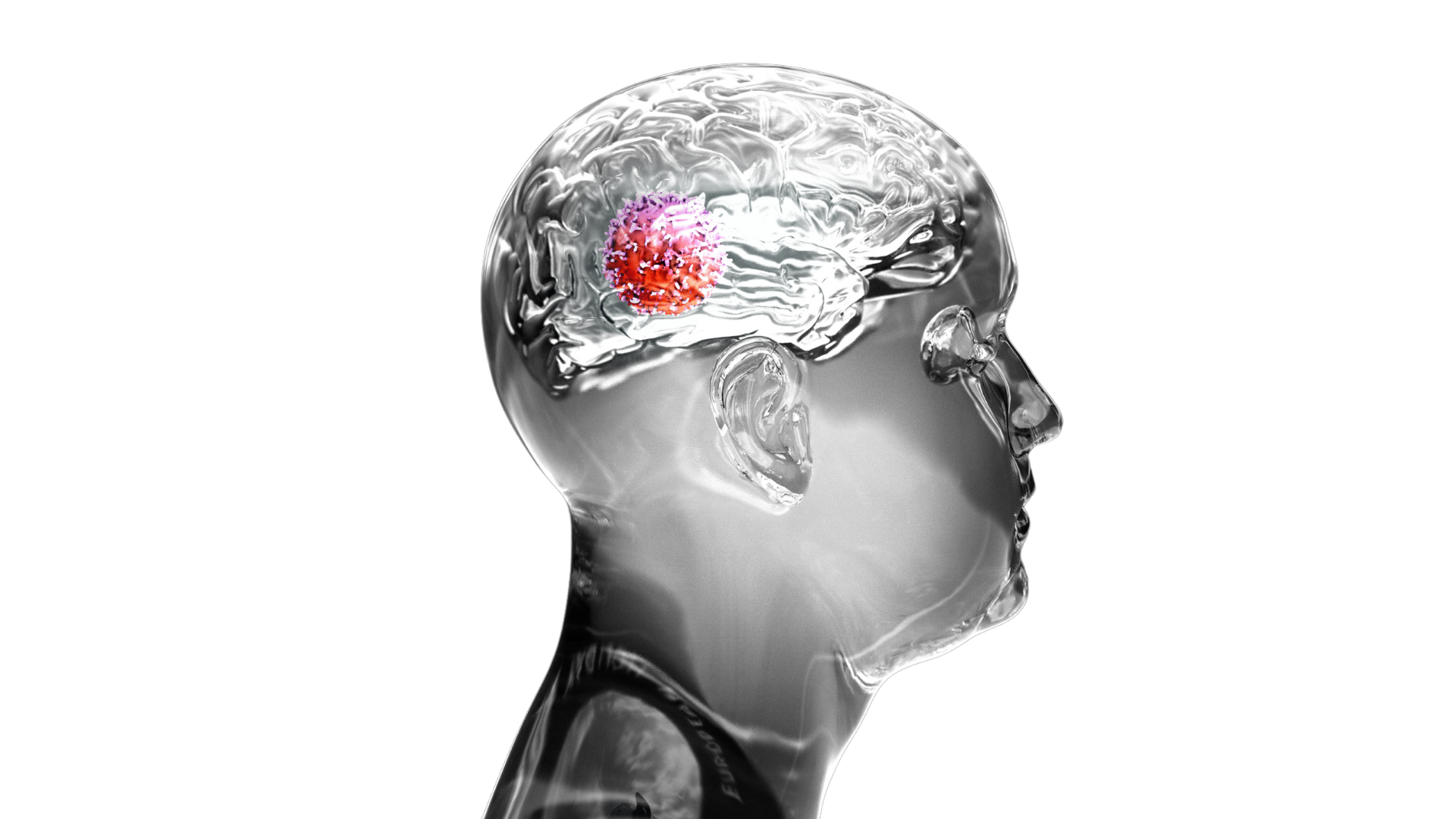 An Introduction To Brain Tumours – CancerMitr