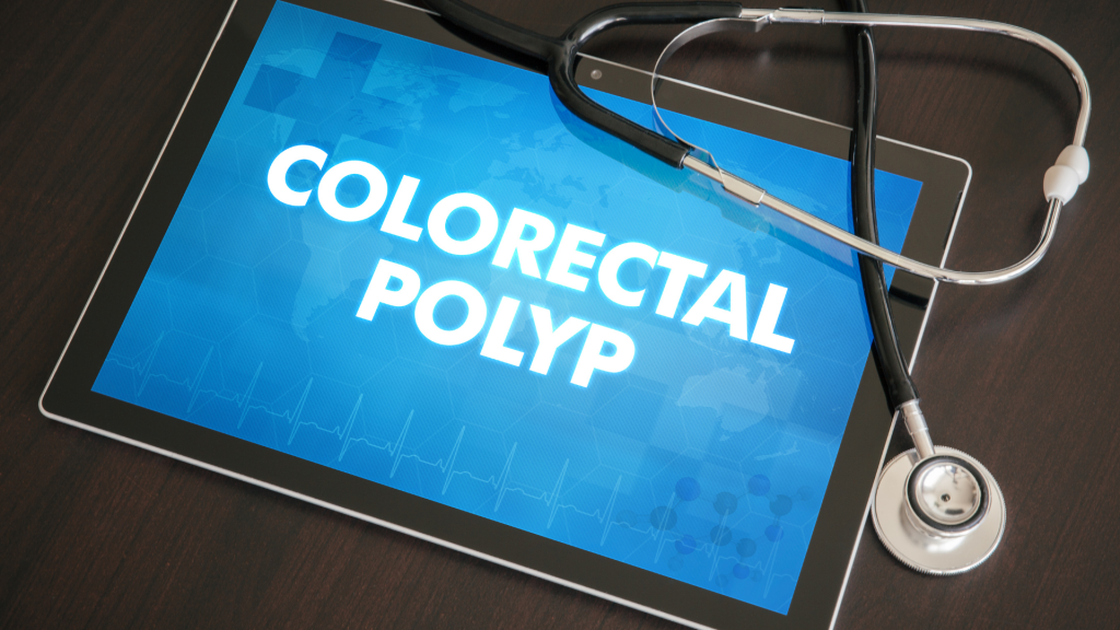 why-it-is-essential-to-remove-colon-polyps-cancermitr