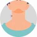 Swelling in the neck or abdomen